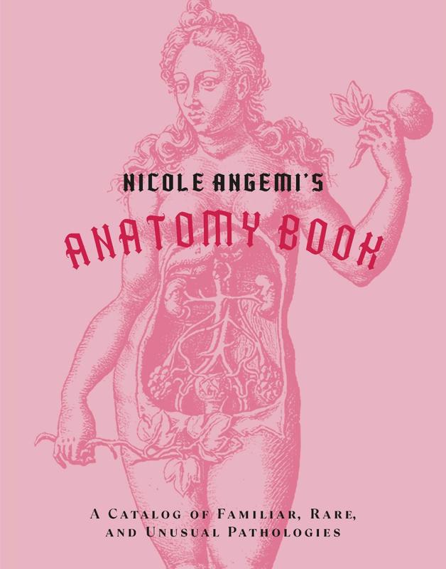 Cernunnos Books > Smarts > Science Nicole Angemi's Anatomy Book: A Catalog of Familiar, Rare, and Unusual Pathologies - Hardcover 9781419754753 MC-33563