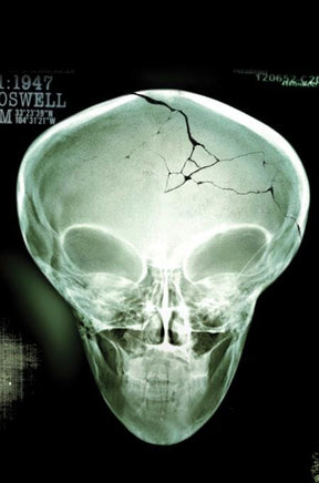 X FILES (2026) #1 - BUNDLE