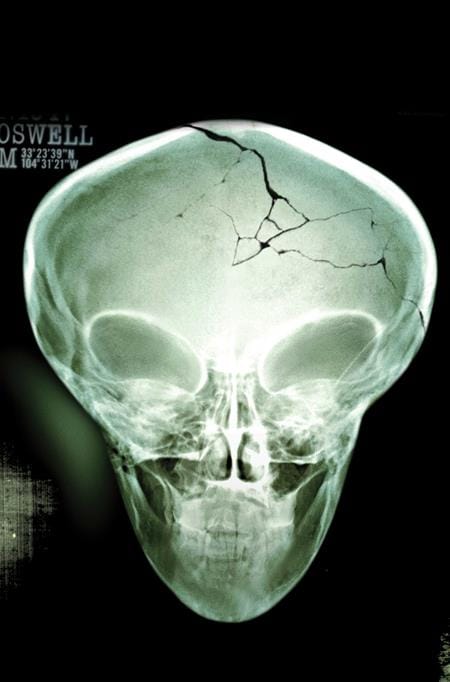 X FILES (2026) #1 - BUNDLE