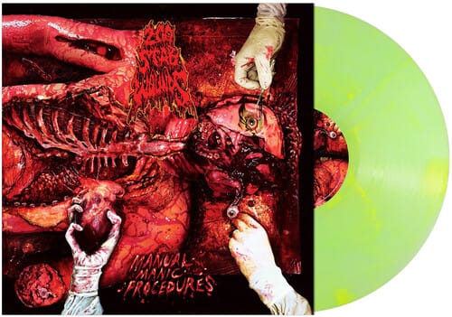 Metal Blade Music > Vinyl Records 200 Stab Wounds - Manual Manic Procedures (Colored Vinyl, Green, Yellow, Marble) 039841621617 MTB162161.1